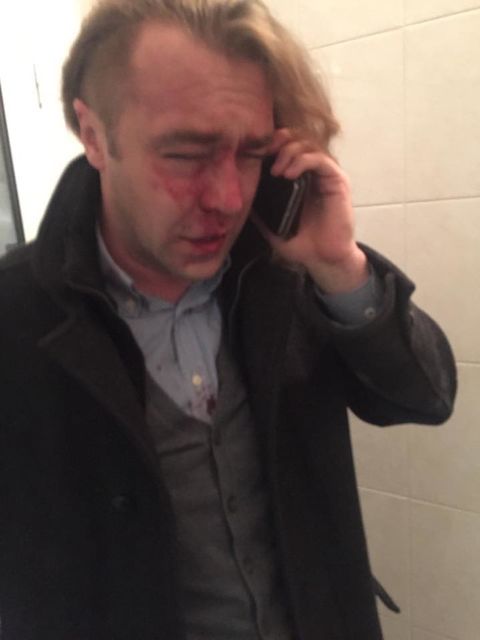 Мирошниченко утверждает, что его избили, фото Facebook/Игорь Мирошниченко
