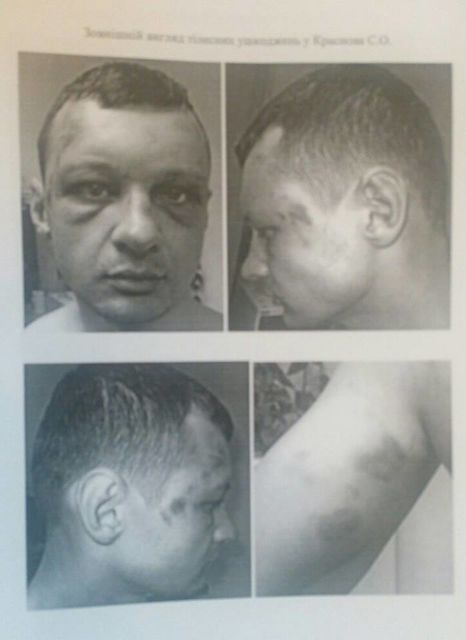 <p>Нардеп оприлюднив фото побитого Краснова і лист Омбудсмена за фактом тілесних ушкоджень, фото І.Мосійчук/Facebook</p>