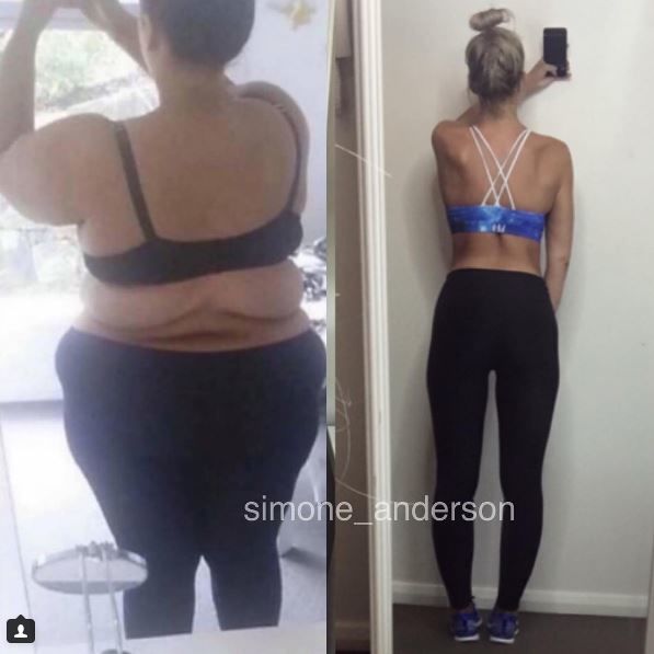 Девушка похудела на 100 кг. Фото: instagram.com/simone_anderson