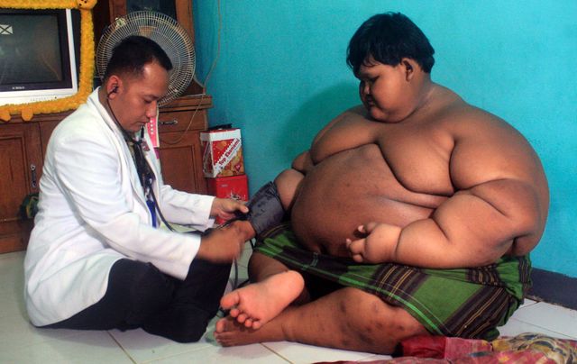 Живущего в Индонезии 10-летнего мальчика, который весит около 192 килограммов, посадили на диету. Фото: AFP