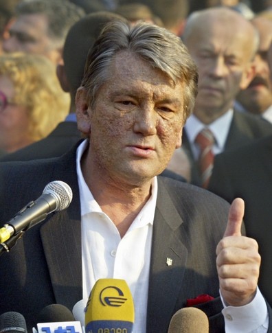 Спустя год. После отравления болезнь Ющенко только прогрессировала. Фото АР