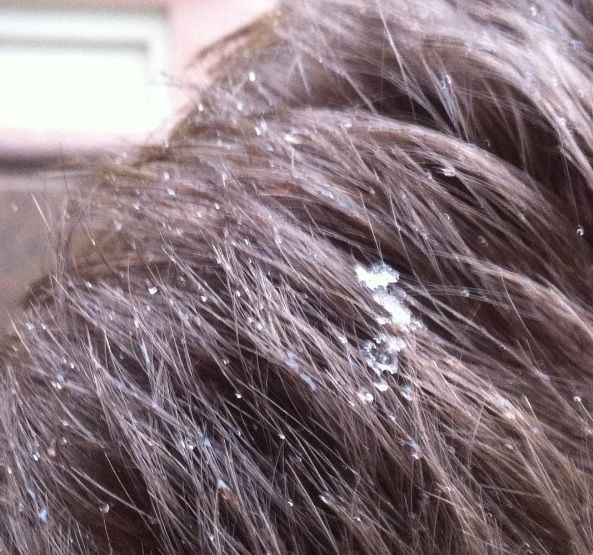 Снег на волосах. Подол. Фото: instagram.com/kristina_surzhenko