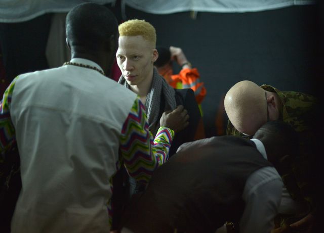 В столице Кении – Найроби – состоялся первый в мире конкурс красоты для альбиносов. Его устроили для того, чтобы привлечь внимание к проблеме преследования людей, испытывающих недостаток пигментации в организме. В конкурсе принимали участие 10 женщин и 10 мужчин. Фото: AFP