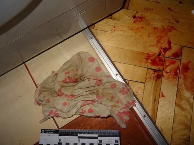 <p>Жінка вдарила чоловіка ножем. Фото: kyiv.npu.gov.ua</p>